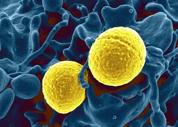 ���ǿ�������Һ�ڵ�ϸ������