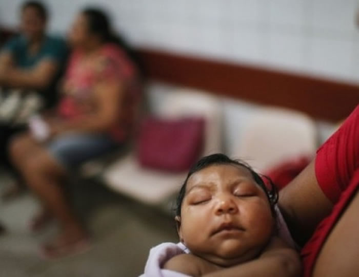 巴西研究人员于小头症婴儿的脑内发现寨卡病毒