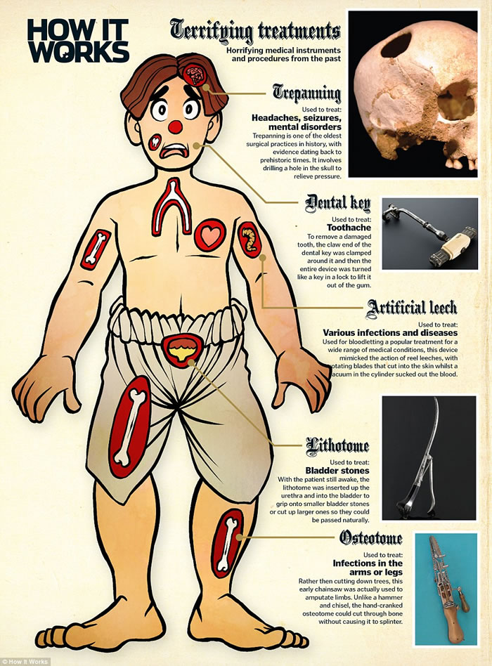 �����־��How it Works�����ܹŴ�Ű�����ߣ���ͭţ���������ҽ���