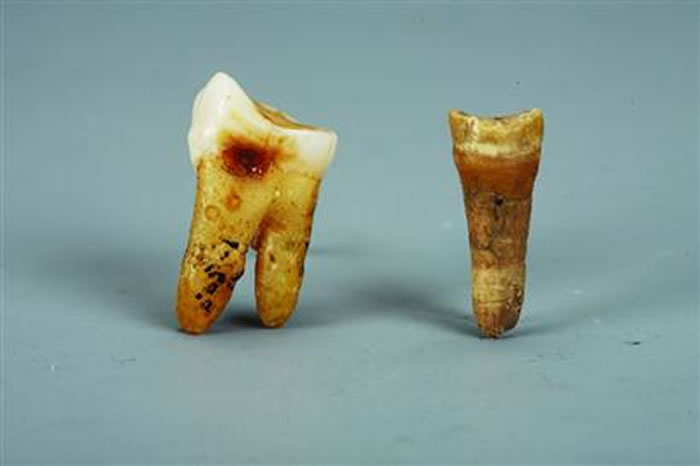 古人类牙齿化石。