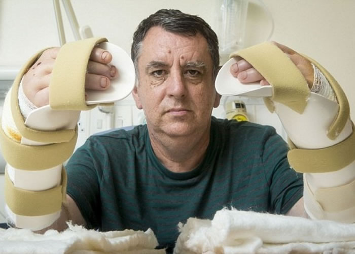 金(图)表示急不及待想看一看自己新的双手。