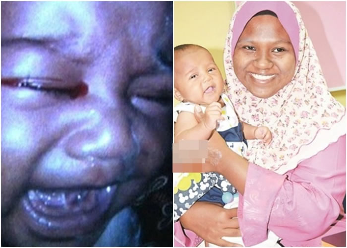 眼见女儿流出血泪,珠拉卡玛(右图右)遂带她入院检查。