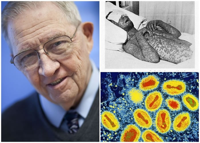 亨德森(左图)生前领导消灭天花工作,造福人类。