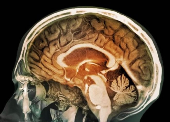 Ӣ���о����ֿ����д�������΢���ܽ��������Բ� ���������˻�֢����