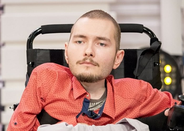 史比利多诺夫患有严重型脊髓性肌肉萎缩症。