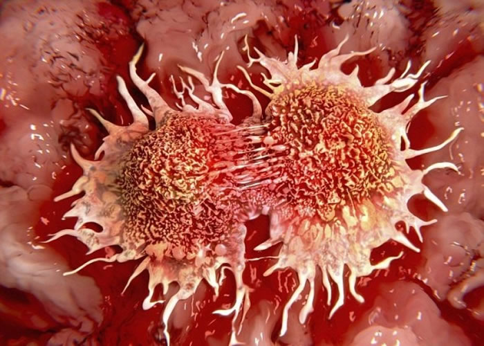 研究指微波可加热杀死癌细胞。