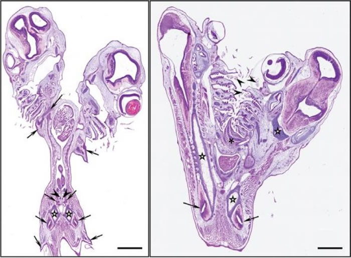 报告指胚胎拥有多组器官。