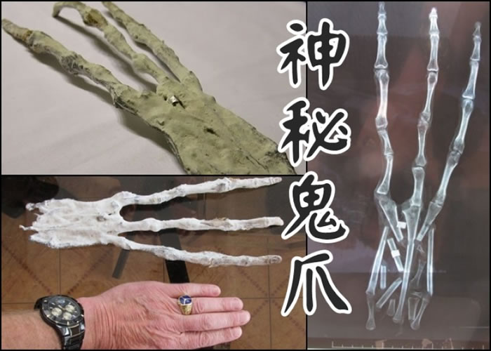 ����צ�����������Ƴ���