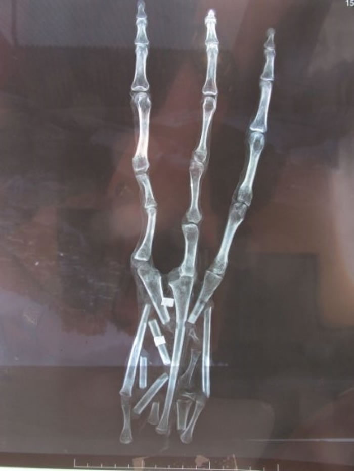 X����ʾ��צ���������ָ��һ��ָ�ǡ�