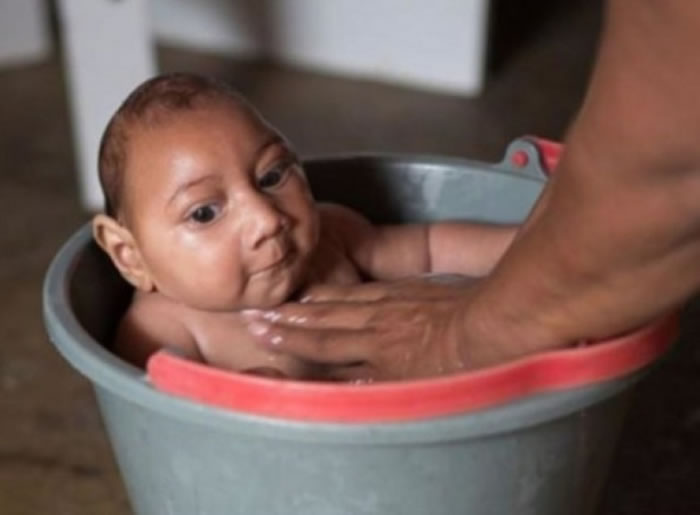 �и����߿��ܵ���Сͷ֢Ӥ����������ͼƬ��