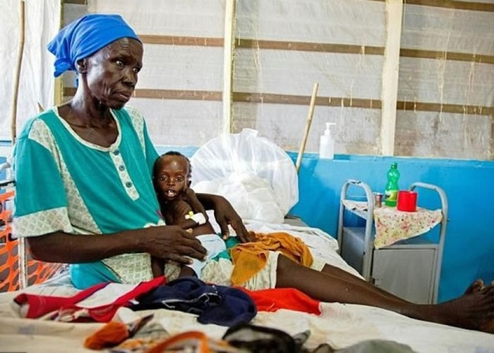 南苏丹一个11个月大严重营养失调的男婴,依在祖母怀抱。