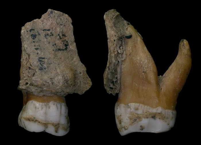 尼安德特人的牙齿特写,显示牙结石在牙釉质上形成一层外壳。 PHOTOGRAPH BY ROYAL BELGIAN INSTITUTE OF NATURE SCI