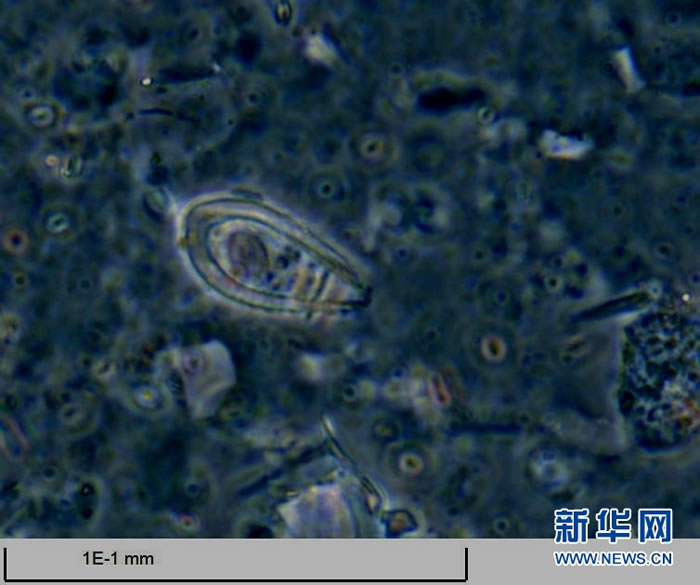 古今尘世知多少,沧海桑田几变迁——在放大1000多倍的显微镜下,“决心”号上的科学家读懂了从南海海底钻取的岩芯中“超微世界”的语言。新华社发(苏翔 摄)