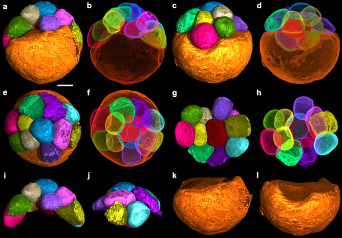 �Ͱ�����Ⱥ�з�����״���Ѷ�����̥��ʯ