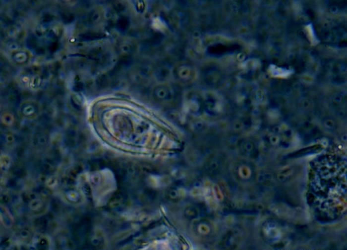 在放大1000多倍的显微镜下,“决心”号上的科学家读懂了从南海海底钻取的岩芯中“超微世界”的语言。新华社发(苏翔 摄)