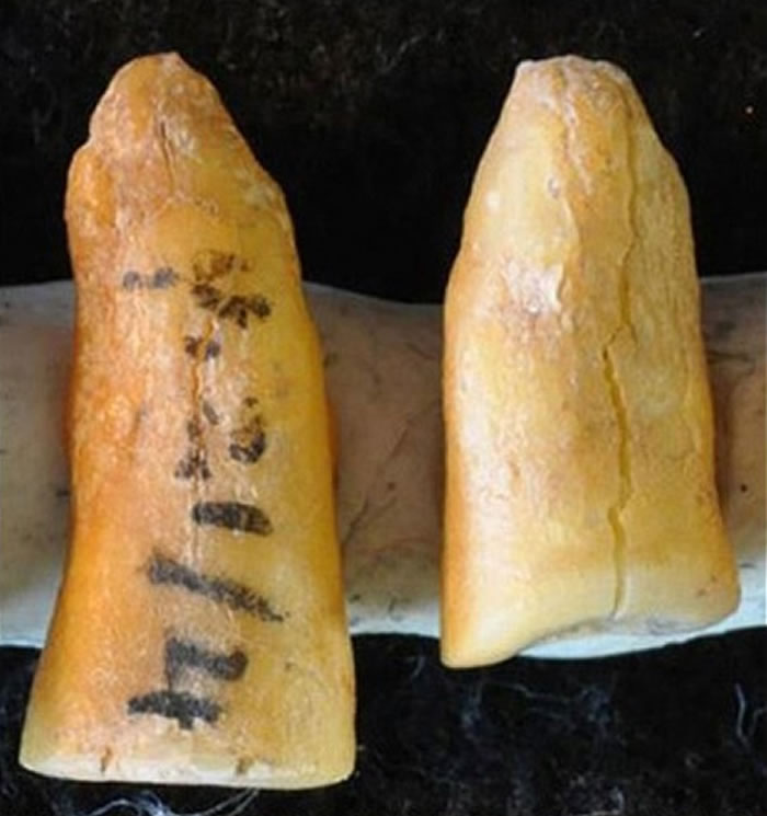 图为在意大利出土的古人牙齿。