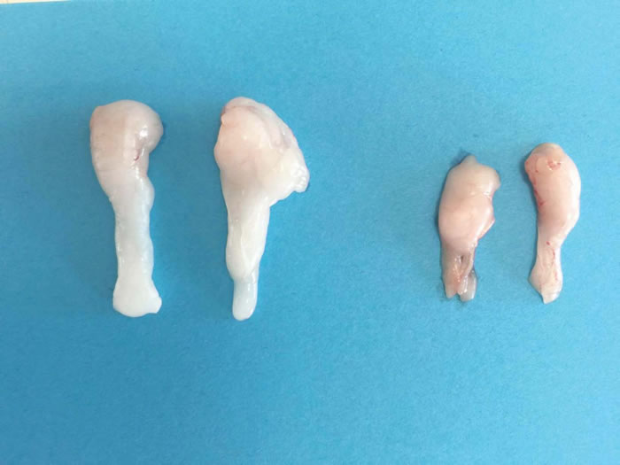 是什么将光照、脂肪和肠道微生物联系在一起?