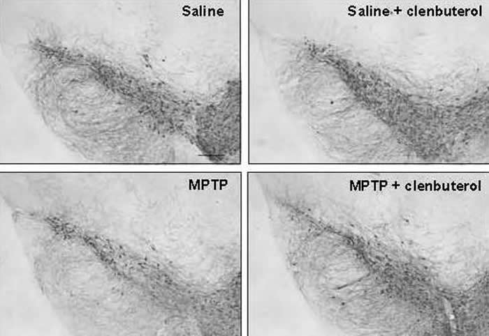 可调控帕金森氏病基因风险因子的化合物