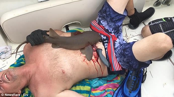 美国佛罗里达州潜水男子下腹遭小鲨鱼紧咬住 强行割开鲨鱼嘴捡回一条命