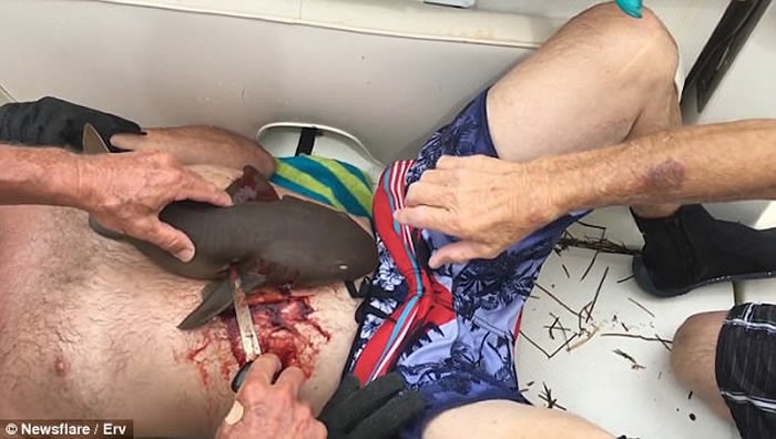 美国佛罗里达州潜水男子下腹遭小鲨鱼紧咬住 强行割开鲨鱼嘴捡回一条命