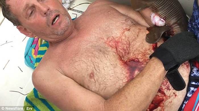 美国佛罗里达州潜水男子下腹遭小鲨鱼紧咬住 强行割开鲨鱼嘴捡回一条命