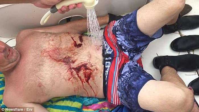 美国佛罗里达州潜水男子下腹遭小鲨鱼紧咬住 强行割开鲨鱼嘴捡回一条命