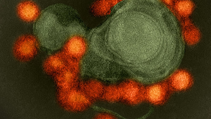 单一基因变化促成能引起严重胎儿小头症的寨卡病毒