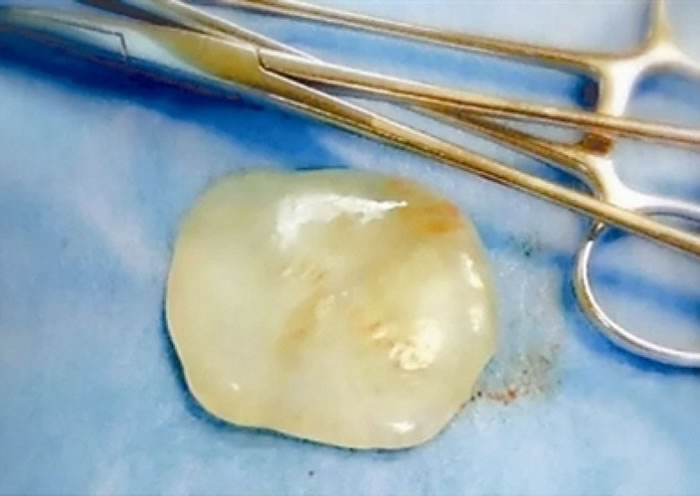 ���ٱ��񡱣��㽭̨����̨�ز����ʸ����ӻ���һ�顰�� ԭ���ǡ���ǻ�������塱