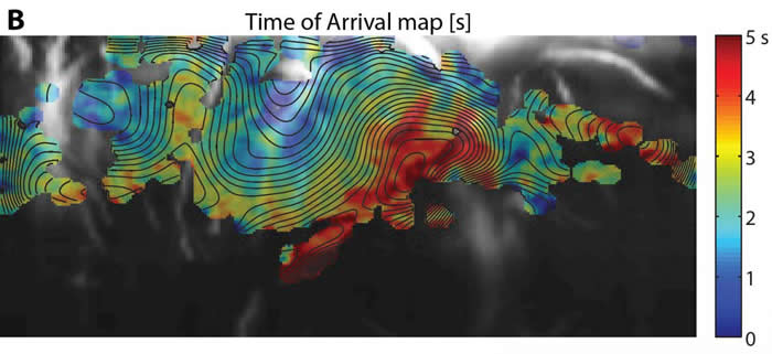 ��ѧ�����һ�ֿ���ֱ�Ӷ�Ӥ���Բ�����г���ı�Яʽ������ɨ����