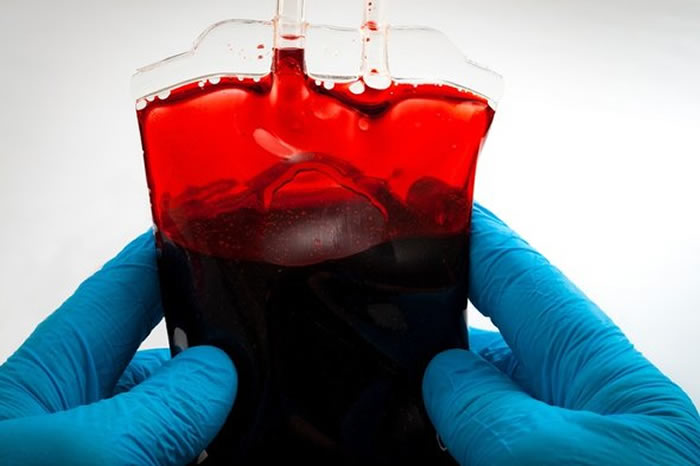 ������ҽѧ����־�������Խ����������еĹ�Ѫ����Ѫ�����������ջ�����