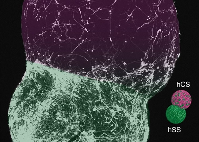 图中显示迷你大脑的运作情况。