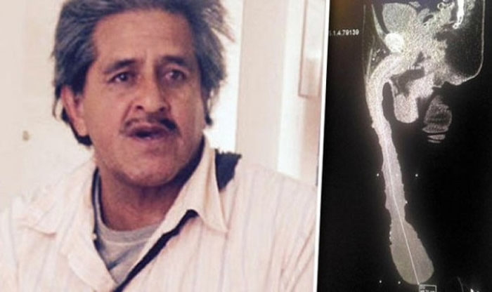 墨西哥54岁男子Roberto Esquivel Cabrera号称拥有世界最长阴茎