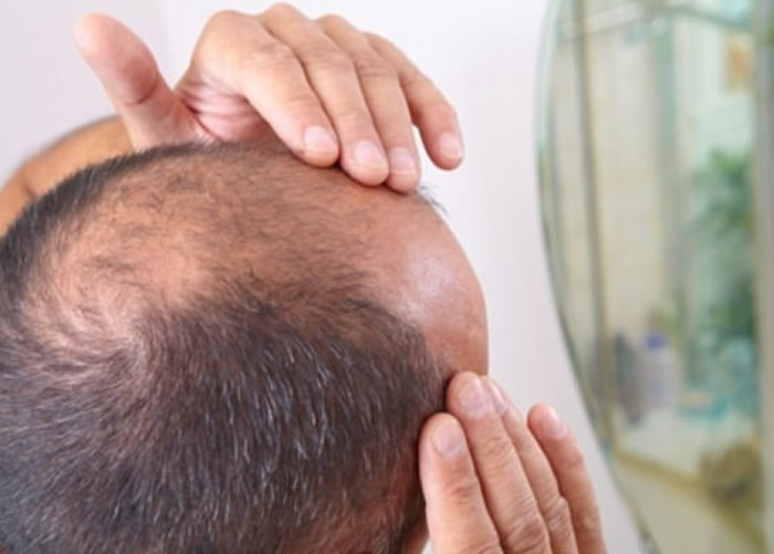 美国科学家利用老鼠干细胞制作会长出毛囊的皮肤组织治秃头