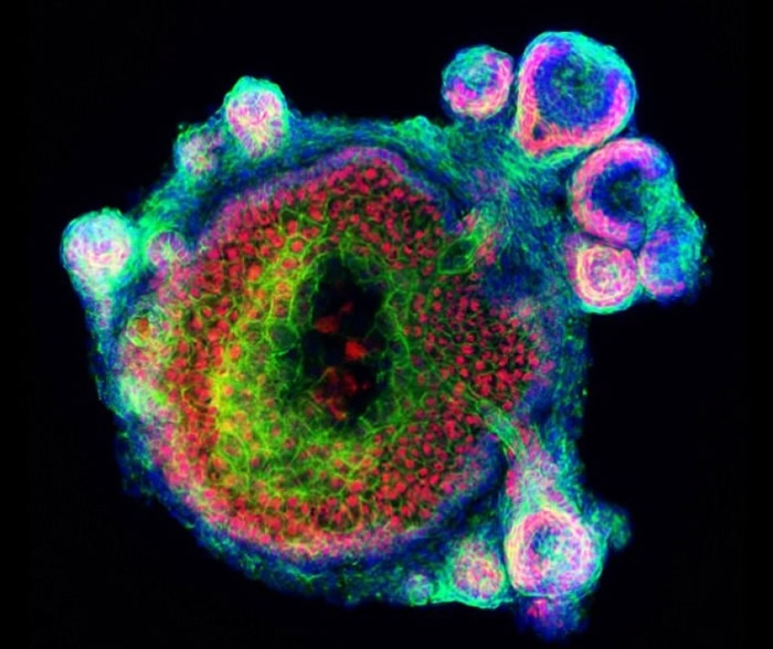 表皮生长期间会像包囊般呈球体,然后真皮会包围着生长。