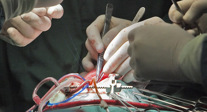 ��Ѫ�ܼ����ѳ�������������Ϊ�й����������ԭ��