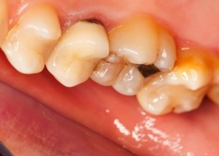 ʱôϣĥݲ躦ݵķʡͼƬ