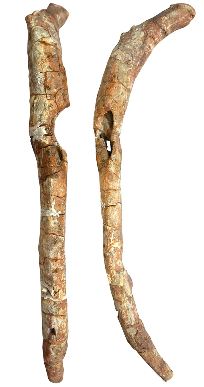 病变肋骨 (摄影 邢立达)