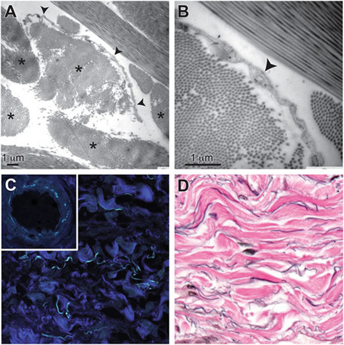 科学家认为,「间质」或许就是导致癌细胞扩散至其他器官的原因。