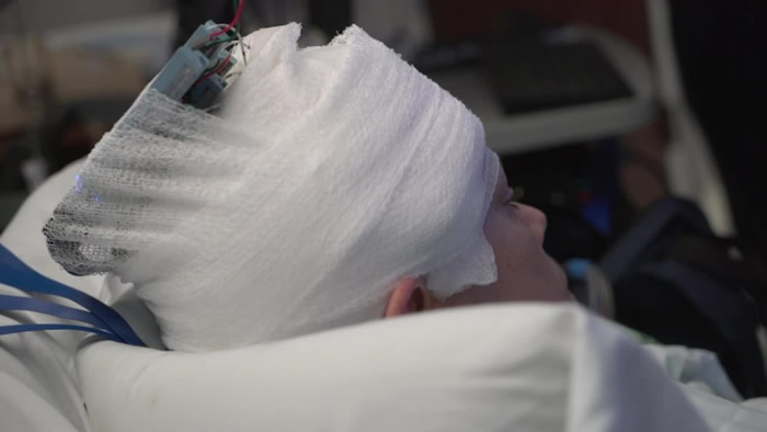 科学家首次以病人的脑细胞编码或模式重建病人失去的记忆。