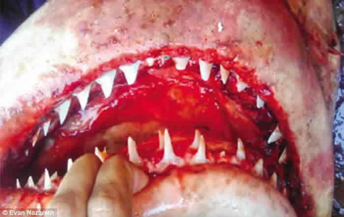 ѧ־ӡ񲶻ʮδϡк衪