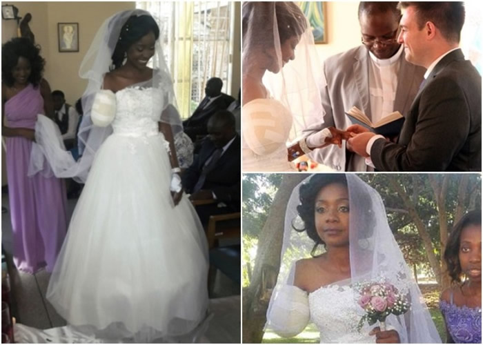 准新娘游津巴布韦遭鳄鱼袭击失去右臂 男友不离弃5日后医院完婚