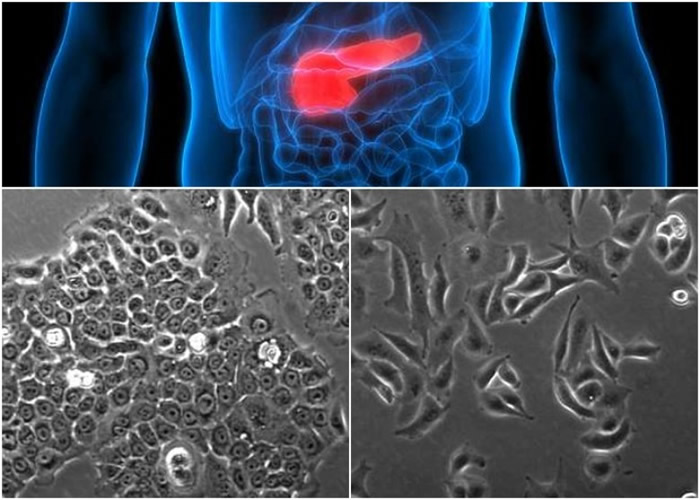 ��ѧ�����ƽ���ϸ���е�С���Ӻ��Ǻ����Ƴ�������ͼ�����ܹ���߻��Ƶ�Ч�ʡ�����ͼΪδ�Ƴ�С���Ӻ��Ǻ���İ�ϸ����