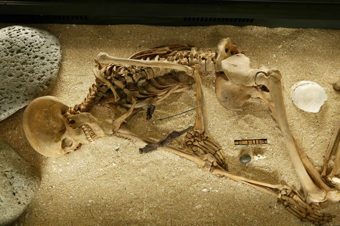 基督教之前(<1000 C.E.)某古代冰岛女性的骨骸。