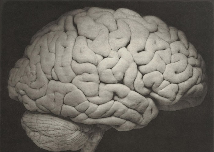 通过更多研究,或可有助对抗认知障碍症。