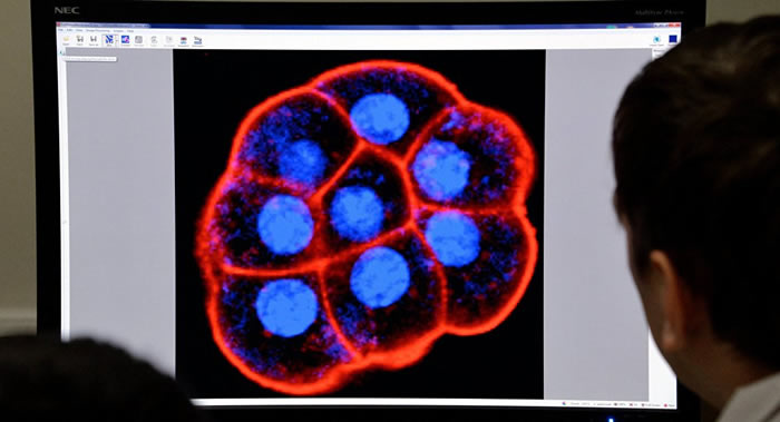 《eLife》:科学家解释人为什么会患上阿尔茨海默病