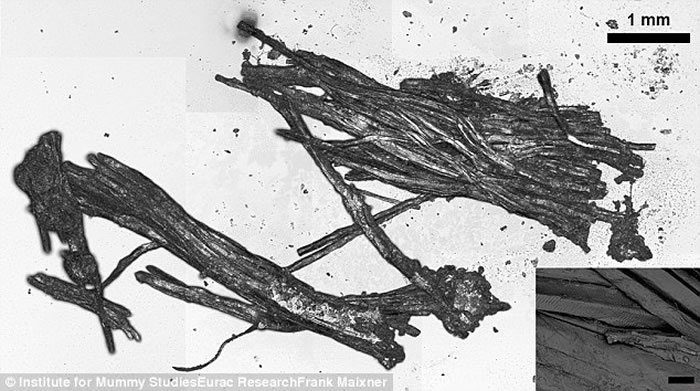 ��ѧ�һ�ԭ5300��ǰ���˰´��������ͣ�һ�붼��Ұ�������¹��ȸ�֬ʳ��