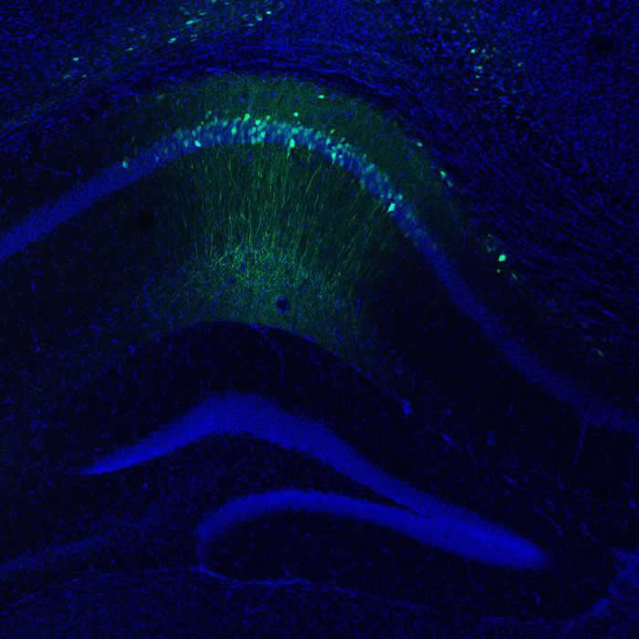 实验进行之前,会先在小鼠身上注射一种含有萤光蛋白的病毒,并在小鼠脑中放置光纤。 PHOTOGRAPH BY STEPHANIE GRELLA