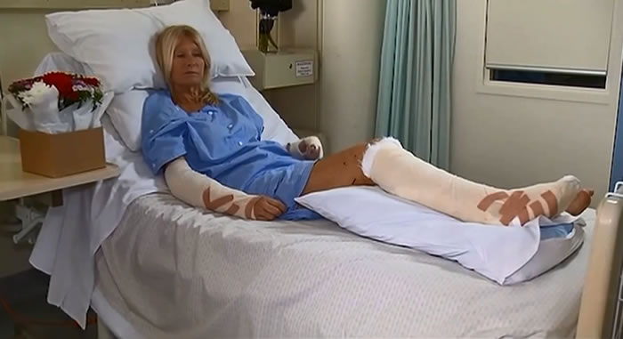 澳大利亚矿山里一群野狗用手机做诱饵差点杀死一名妇女