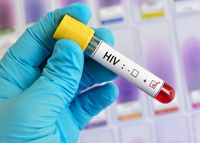 加拿大专家发现变种的HIV病毒可让人在一个月内发病。