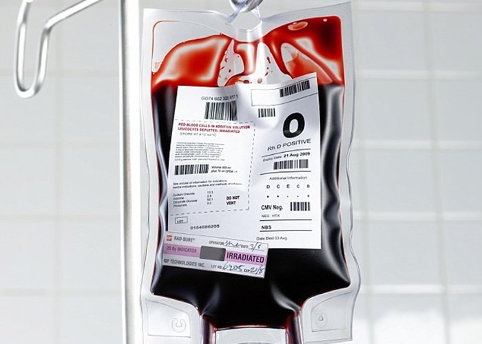 《自然》期刊:年轻人的血液或有助长者回复青春及恢复健康